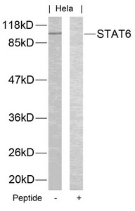 STAT6 (Ab-645) Antibody