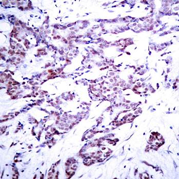 STAT6 (Phospho-Thr645) Antibody