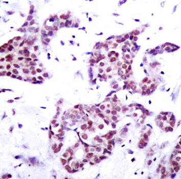 STAT6 (Phospho-Tyr641) Antibody