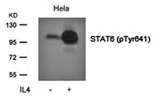 STAT6 (Phospho-Tyr641) Antibody