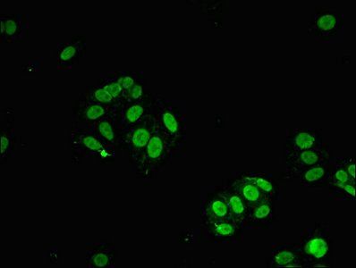 STAT6 Antibody