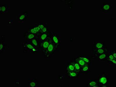 STAT6 antibody