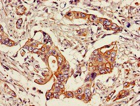 STAT6 Antibody