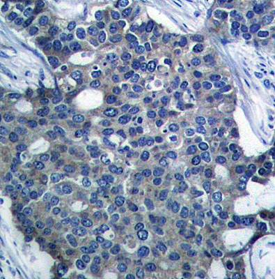Stathmin 1 (Ab-25) Antibody