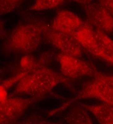 Stathmin1 Rabbit Polyclonal Antibody