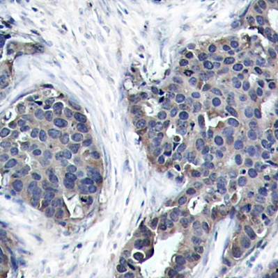 Stathmin1 Rabbit Polyclonal Antibody