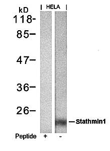 stathmin1 (Ab-62) Antibody