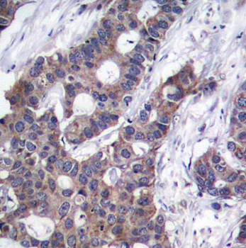 Stathmin 1 (Phospho-Ser16) Antibody