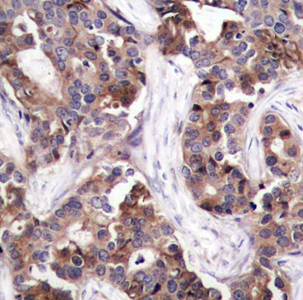Stathmin 1 (Phospho-Ser25) Antibody
