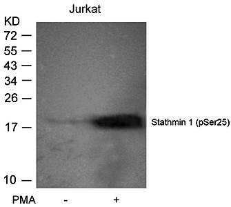 Stathmin 1 (Phospho-Ser25) Antibody