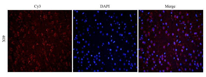 Stathmin antibody