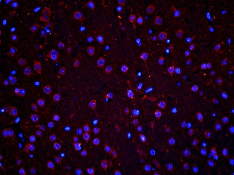 Stathmin antibody