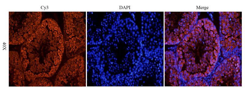 Stathmin antibody