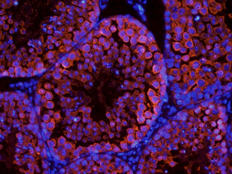 Stathmin antibody