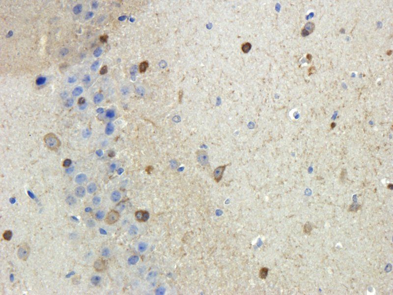 Stathmin antibody
