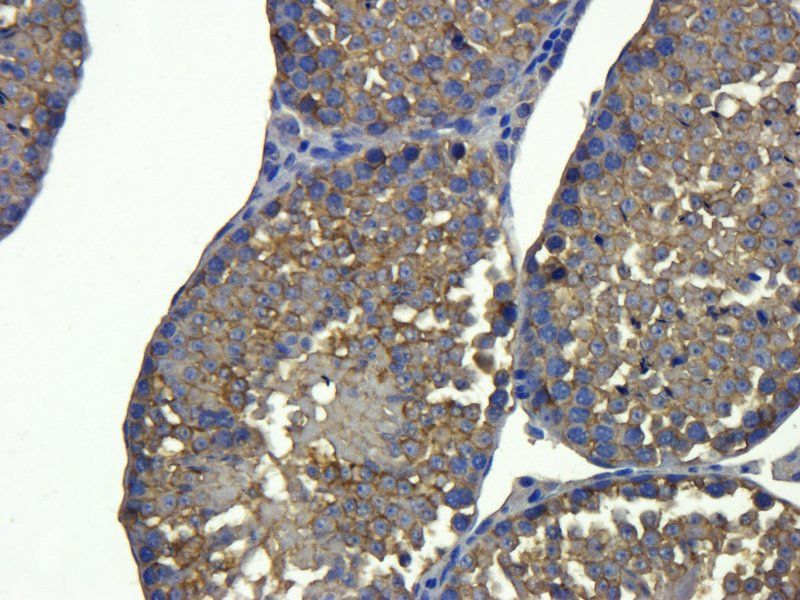 Stathmin antibody