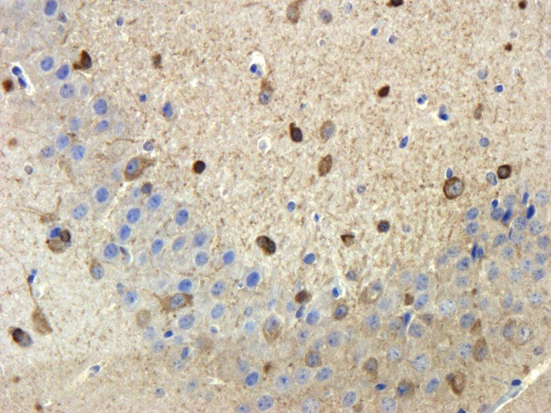 Stathmin antibody