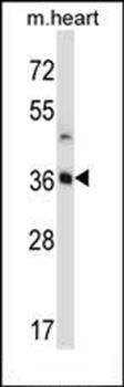 STC2 antibody