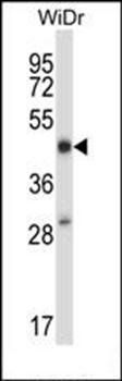 STEAP1 antibody