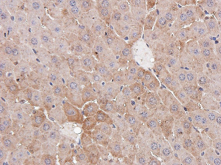 STEAP1 antibody