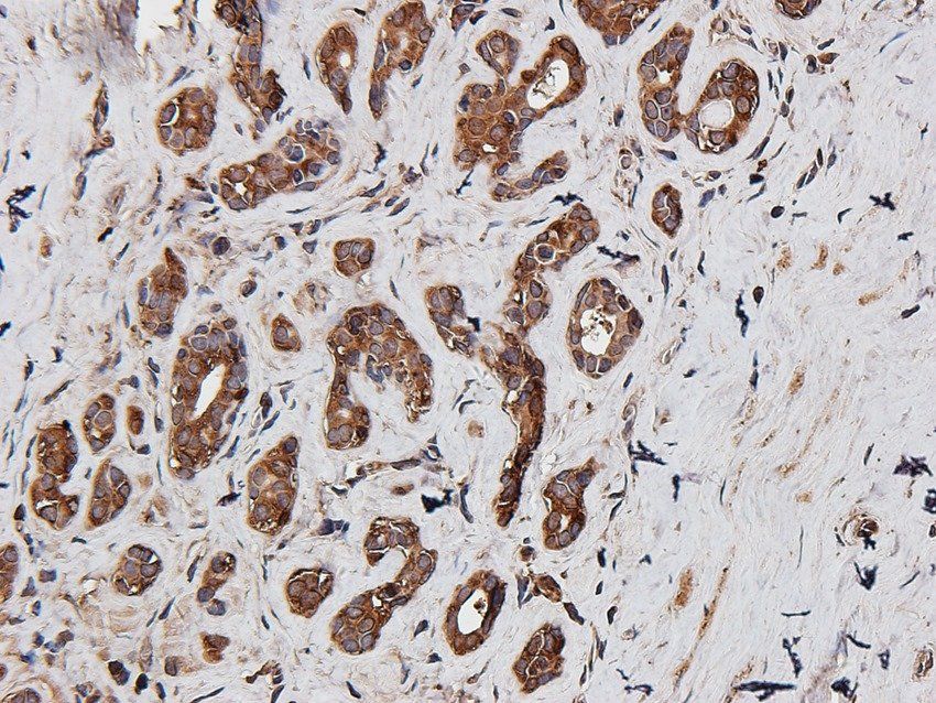 STEAP1 antibody