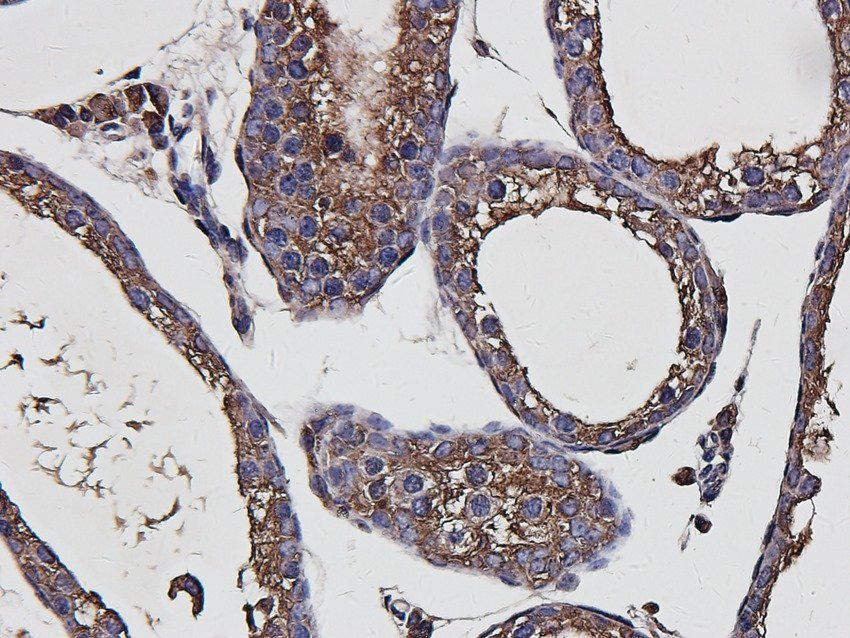 STEAP1 antibody