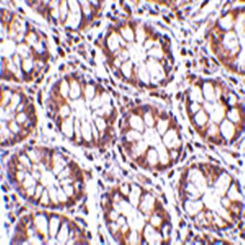 STEAP2 Antibody