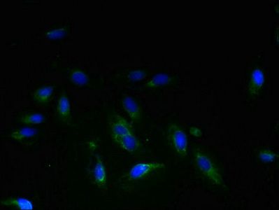 STEAP3 antibody