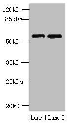 STEAP3 antibody