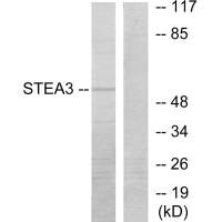 STEAP3 antibody