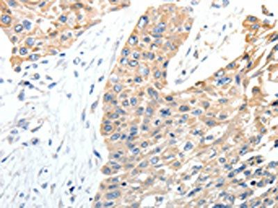 STEAP4 Antibody