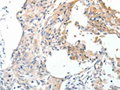 STEAP4 Antibody