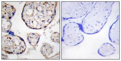STEAP4 Antibody