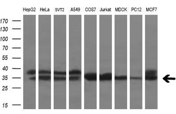CSTB Antibody