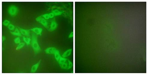 Stefin B Antibody