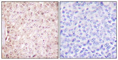 Stefin B Antibody