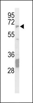 STEP / PTPN5 antibody
