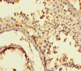 Steroid 17-alpha-hydroxylase/17, 20 lyase antibody