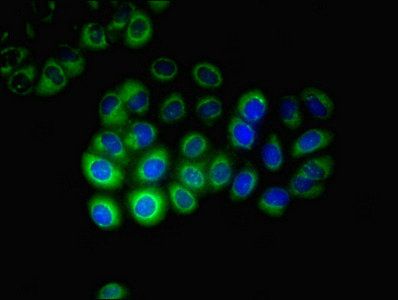 Steroid 17-alpha-hydroxylase/17, 20 lyase antibody