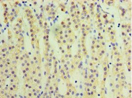 CYP17A1 Antibody