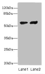 Steroid 17-alpha-hydroxylase/17, 20 lyase antibody