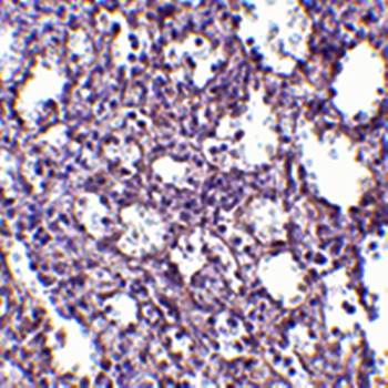 STIM2 Rabbit Polyclonal Antibody