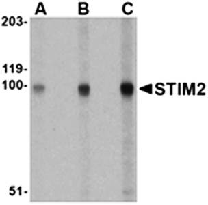 STIM2 Rabbit Polyclonal Antibody