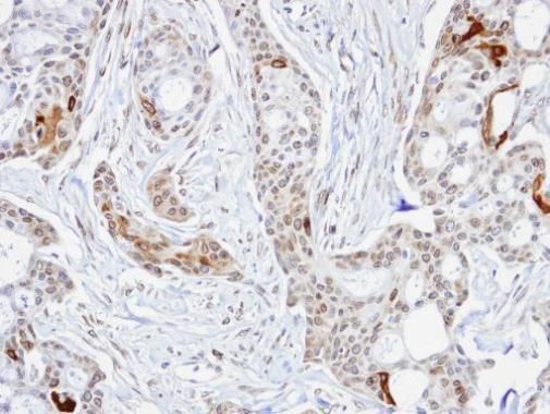 stress induced phosphoprotein 1 Antibody