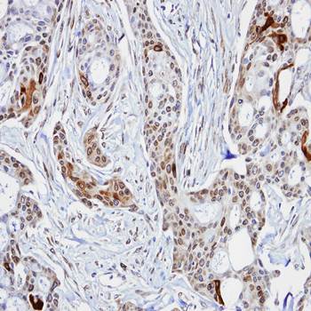 STIP1 antibody