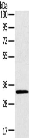 STK16 antibody