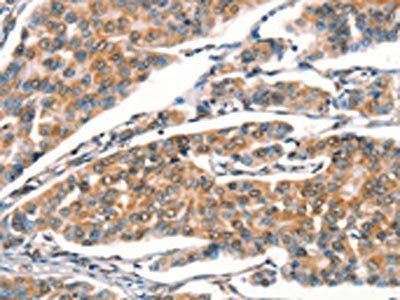 STK17A Antibody