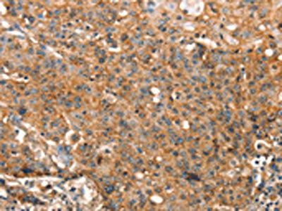 STK17A Antibody