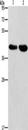 STK17A antibody