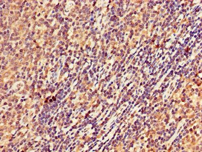 STK17B Antibody